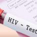 Realizan test gratuitos para detectar VIH y sífilis